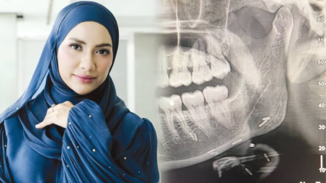 ‘Doktor tak percaya sampai pasang zikir, ingat saya pakai susuk’