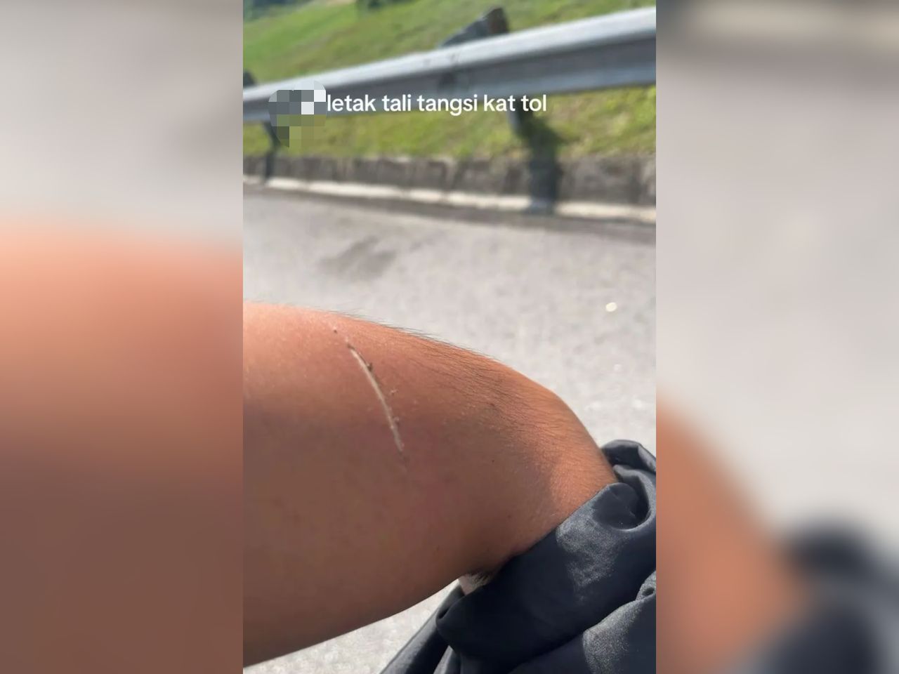 Berbirat tangan kena jerat tali tangsi di plaza tol