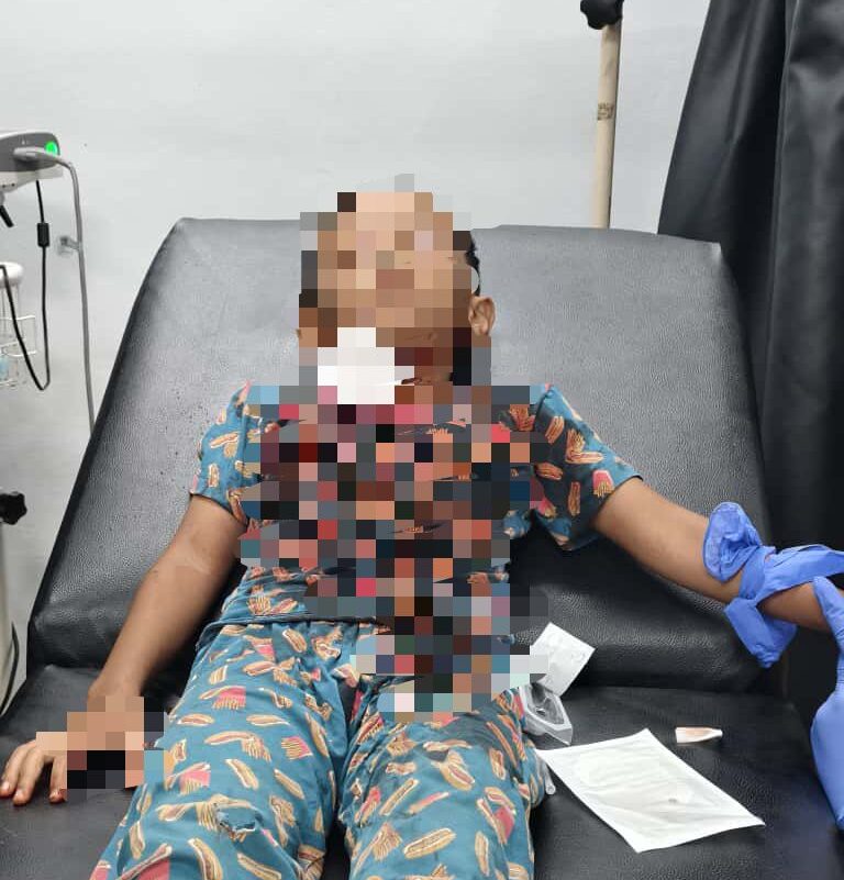 Budak kena kelar stabil, sudah boleh bercakap