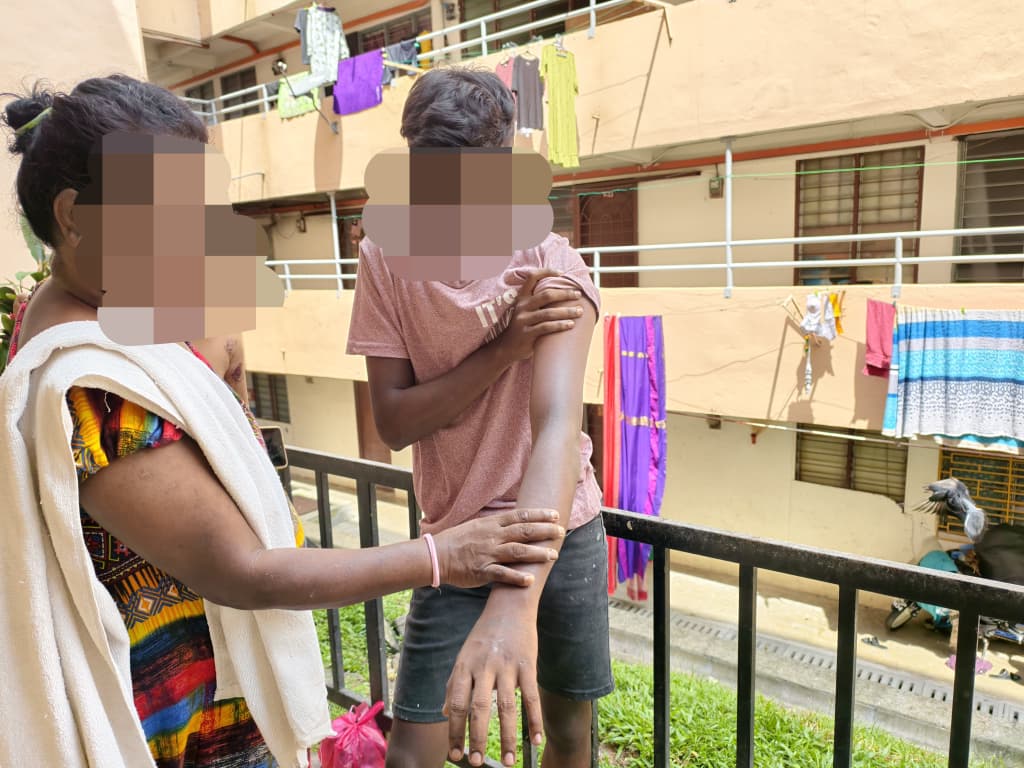 OKU kena samun, pukul datang KL, terima kasih bantu anak saya