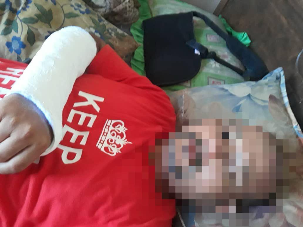 Ejen insurans parah dibelasah jiran menang saman RM461,600