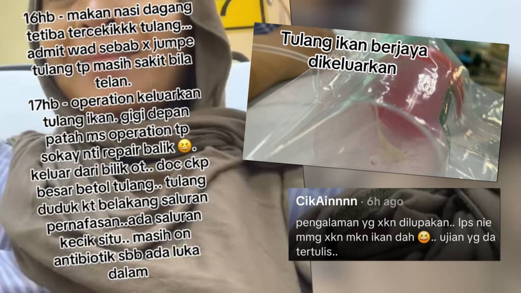 [VIDEO] Jalani dua pembedahan tercekik tulang ikan