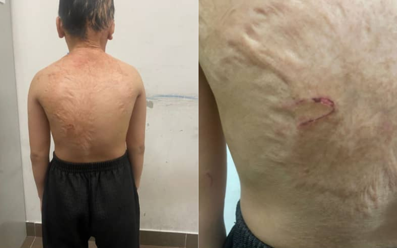 Budak lelaki ditemui kelaparan, rupanya kena dera