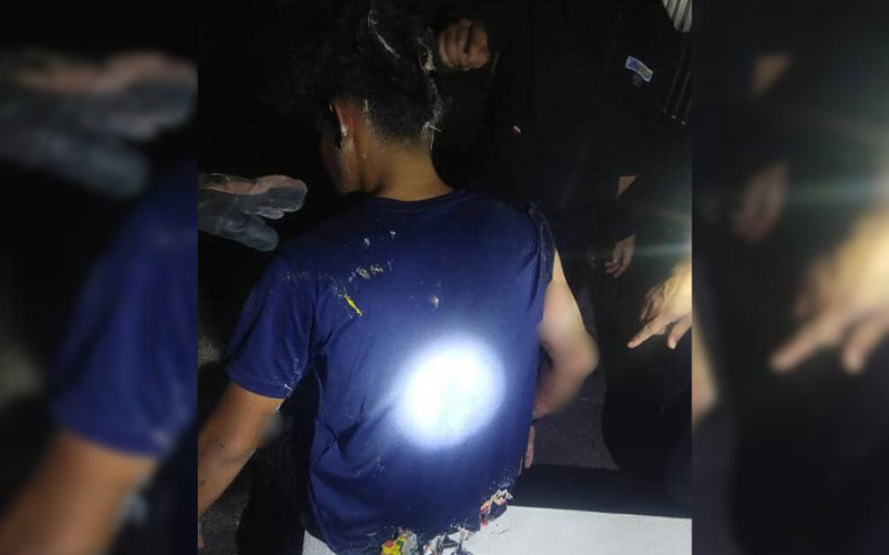 Penguat kuasa MBPP melecur, belon helium disita meletup