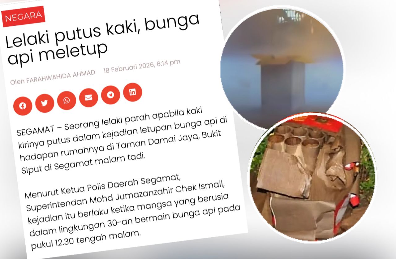 Polis buru penjual bunga api punca lelaki putus kaki