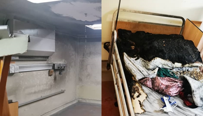 Pesakit melecur, tabung oksigen hospital terbakar