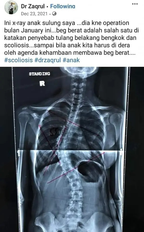 Berat isu beg sekolah 7 Pendekatan