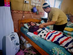 Sering demam, ingatkan ada mistik rupanya SLE