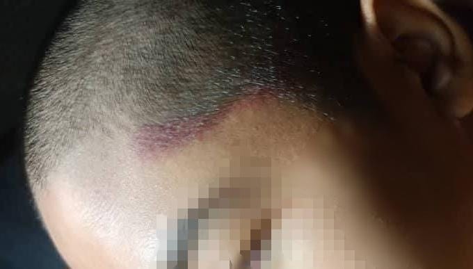 Pelajar tahfiz dakwa ditampar warden, makan roti tanpa kebenaran