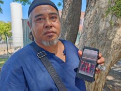 Gadis meninggal dunia selepas 9 hari bertarung nyawa, kaki dipotong