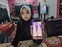 ‘Sakitnya macam dicucuk-cucuk dengan jarum’