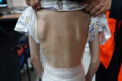Budak 11 tahun didera, disimbah air panas