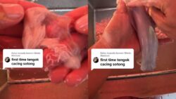 Penggemar ikan, sotong mentah berisiko dapat jangkitan cacing anisaki