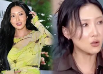 Alat komunikasi di telinga meletup, gegendang kiri Hwasa rosak