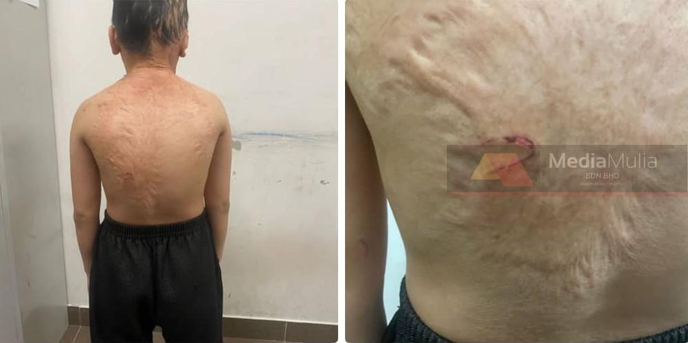 ‘Tak sangka pula dia terlibat dalam kes dera’