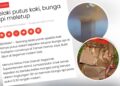 Polis buru penjual bunga api punca lelaki putus kaki