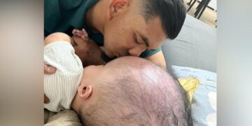 [VIDEO] Usia 9 bulan, berat kepala Mateen hampir 20kg