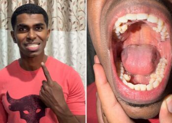 Lelaki Malaysia pecah rekod dunia, miliki 42 batang gigi