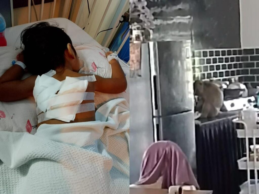 Budak dua tahun terima 20 jahitan cedera digigit kera