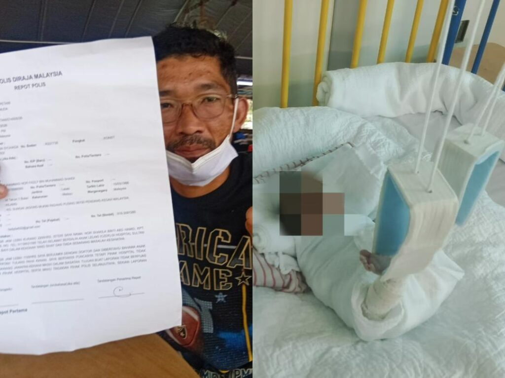 Polis siasat kes bayi patah tulang paha