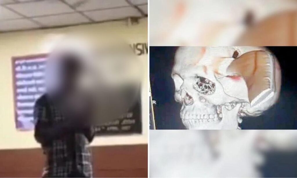 Lelaki datang hospital dengan kepala tertusuk sabit