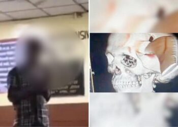Lelaki datang hospital dengan kepala tertusuk sabit