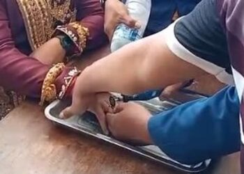 Bomba terpaksa potong cincin kahwin, pengantin lelaki salah pakai